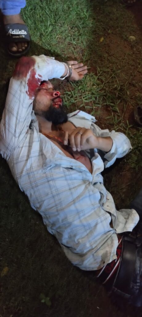 जलडहर पेट्रोल पंप के पास तेज रफ्तार कार ने बाइक को मारी टक्कर, युवक गंभीर