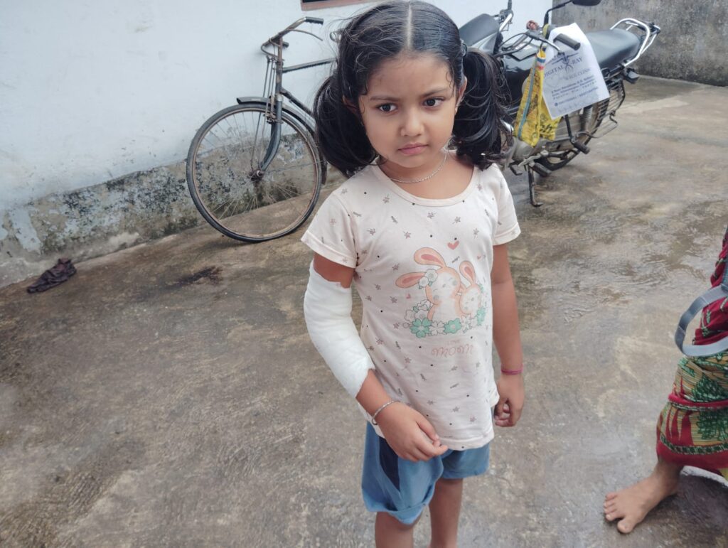 नूतनडीह में जर्जर विद्यालय भवन का हिस्सा गिरने से दूसरी कक्षा की छात्रा घायल, अब बरामदे में बैठ रहे हैं बच्चे
