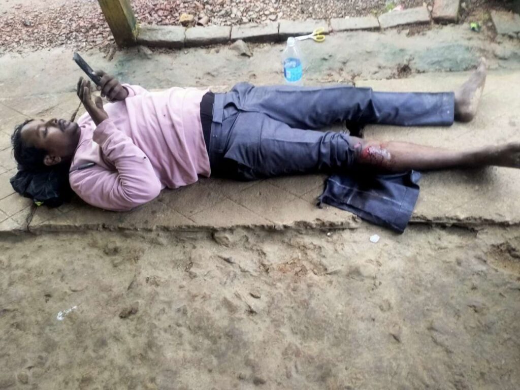 कुत्ते को बचाने के प्रयास में बाइक सवार दुर्घटनाग्रस्त, पैर की हड्डी टूटी