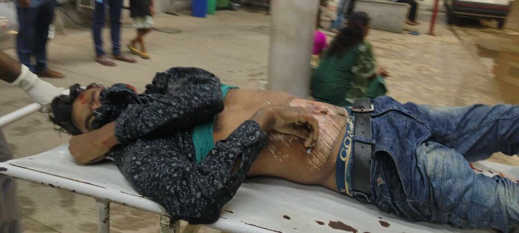 बोड़ाम के पगदा में 709 ट्रक की टक्कर से बाइक सवार युवक की मौत, चचेरा भाई गंभीर
